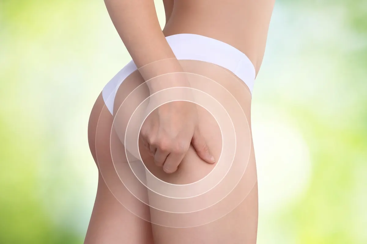 sport qui elimine la cellulite